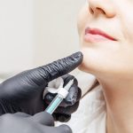 Natural chin botox before and after results for smoother facial contours
