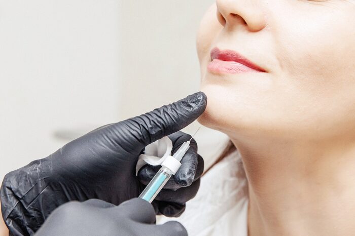Natural chin botox before and after results for smoother facial contours